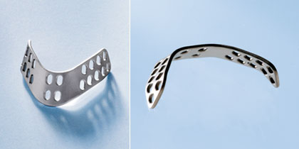 Breathe Implant àWengen